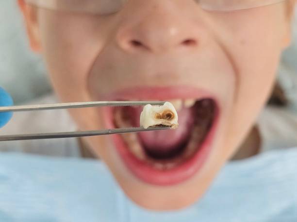 Best Emergency Pediatric Dental Care in Monmouth Beach, NJ